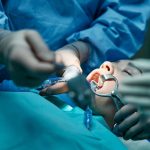 Oralna kirurgija med kirurškim posegom v ustni votlini pod anestezijo.